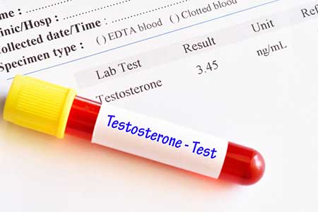 Low Testosterone Level Testing and Treatment in Portsmouth, NH