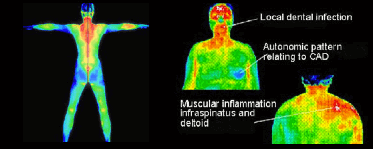 Full Body Thermography Portsmouth